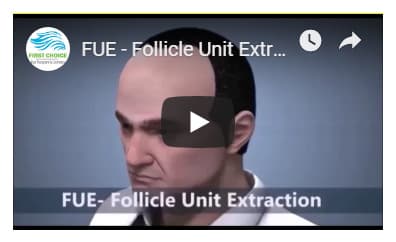 First Choice Hair Transplant & Cosmetics