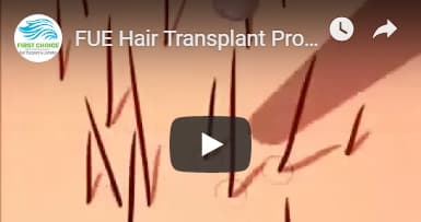 First Choice Hair Transplant & Cosmetics