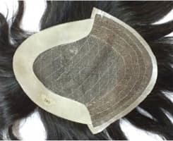 Artificial Hair Restoration