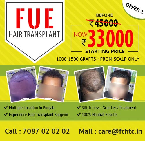 Hair Transplant Special Offers